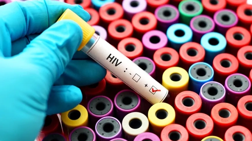 Odkryto ważny mechanizm infekcji HIV